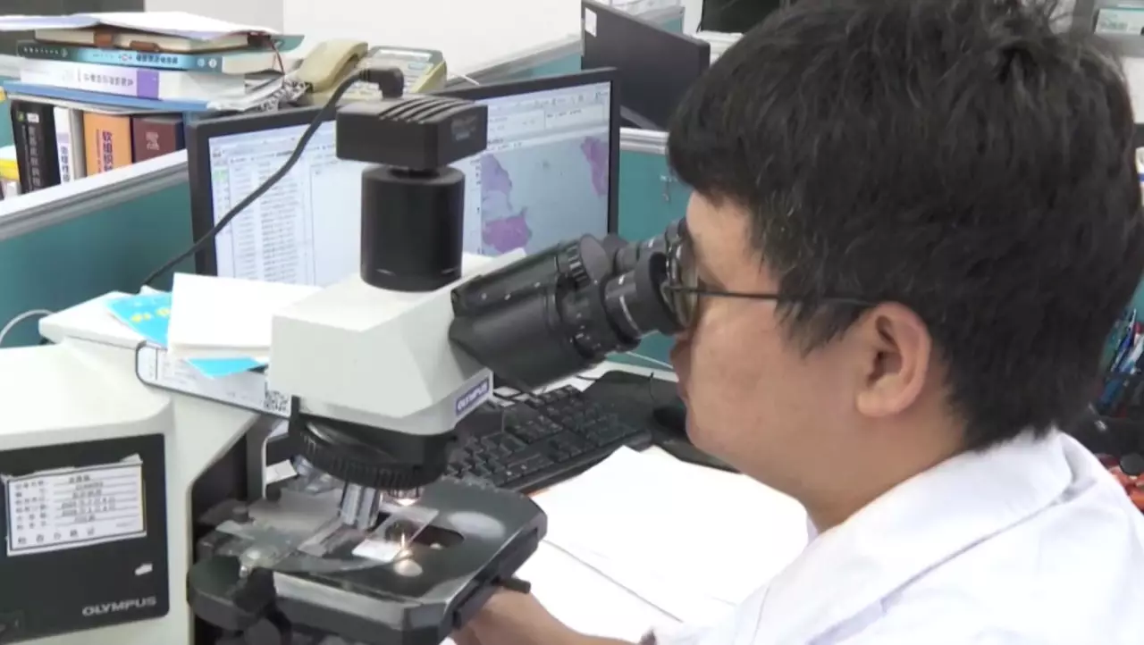 Қытайда қатерлі ісікті анықтайтын ЖИ іске қосылды