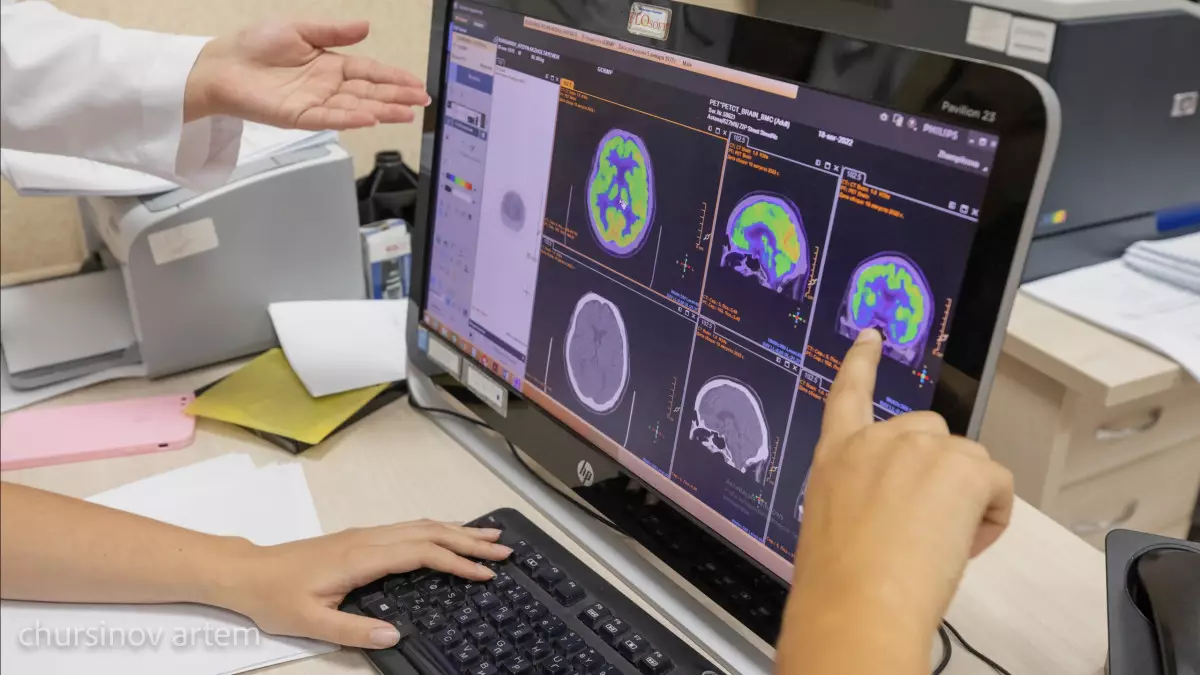 Ғалымдар жаңа жүйке ауруын анықтады