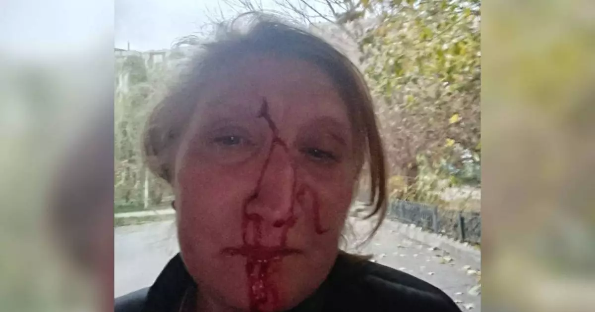  Курьер избил охранницу алматинского ЖК за замечание 