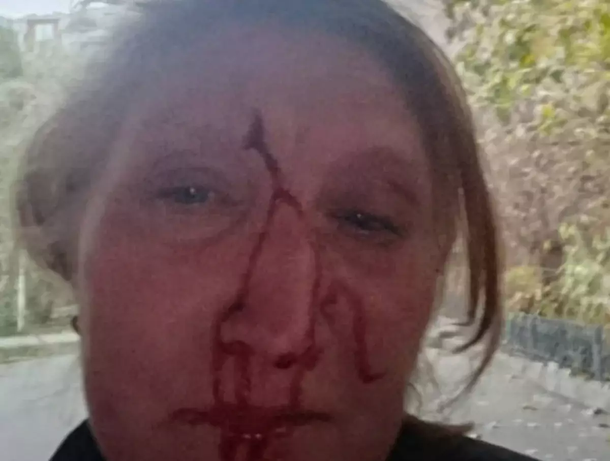 Курьер избил охранницу жилого комплекса в Алматы