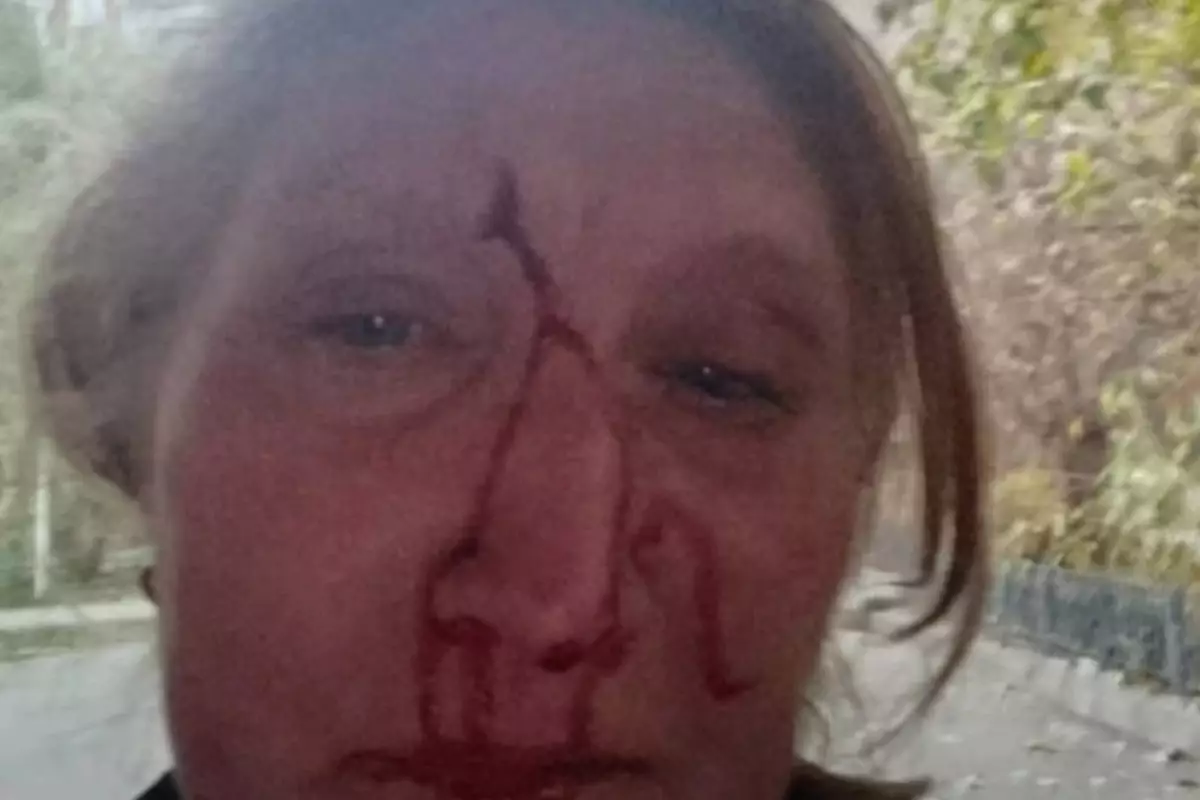 В Алматы женщина-охранник пострадала после нападения курьера