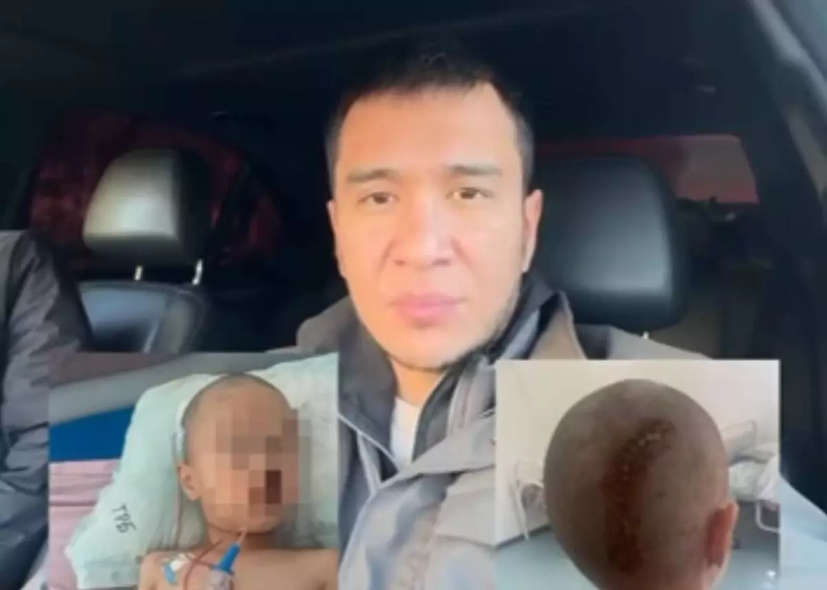 Атырауда балабақшада үш жасар бала басынан қатты жарақат алған