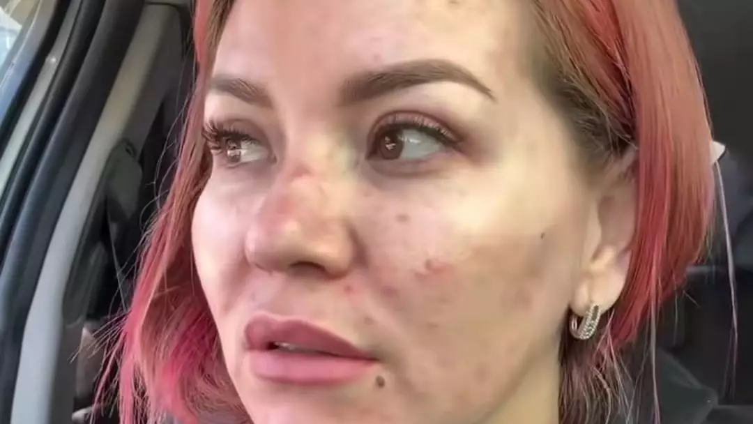 Әсел Асқардың жарнамасына сенген қыз ажарынан айырылды