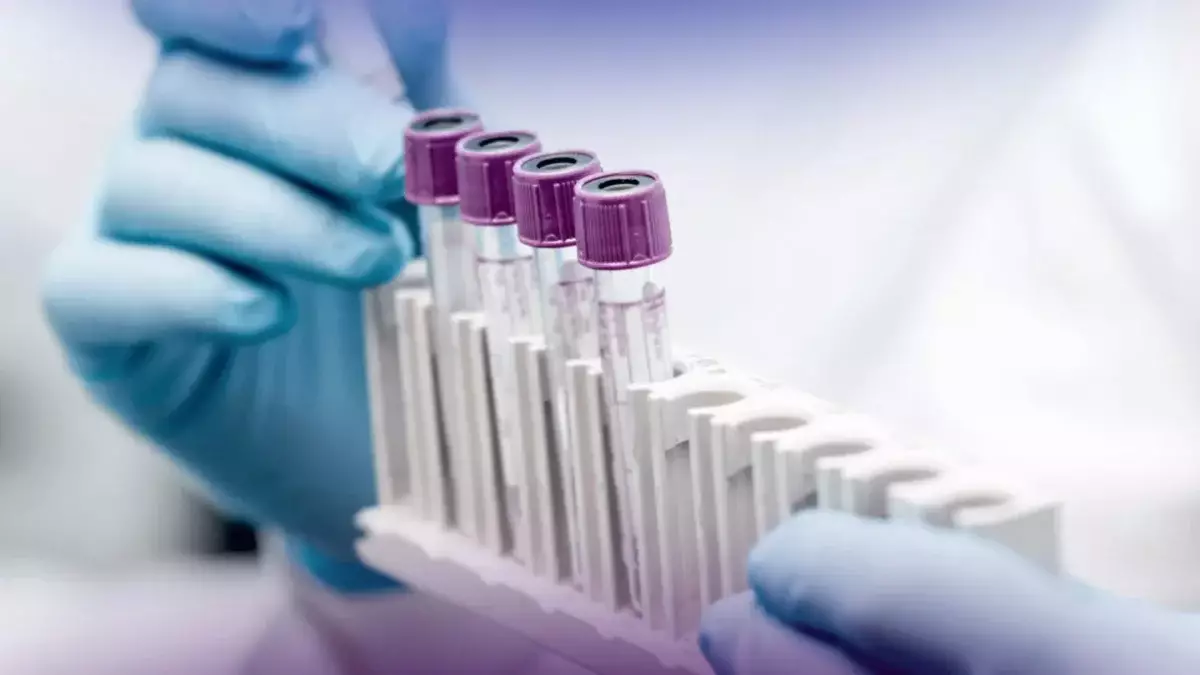 Тұмау вирусы: Алматыда эпидемиологиялық ахуал тұрақты