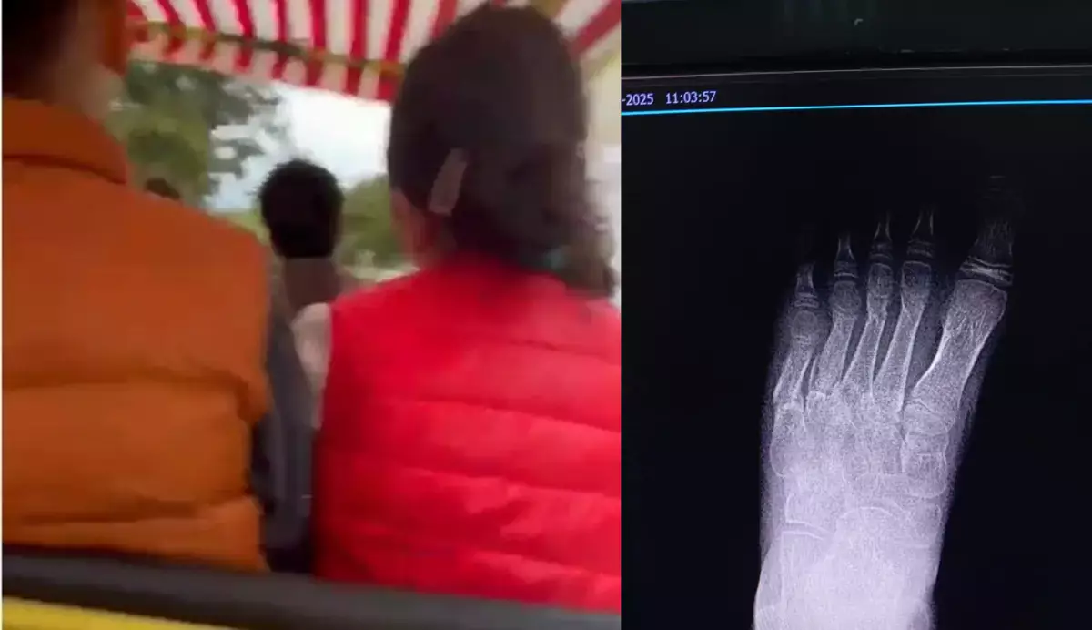 Развлечения, которые калечат в Актау: очередной несчастный случай произошел в парке «Акбота» - новости на Lada.kz 06.11.2025