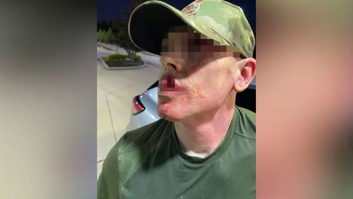 Сотрудник иммиграционной службы США получил серьёзные травмы после нападения нелегального иммигранта с металлической кружкой.