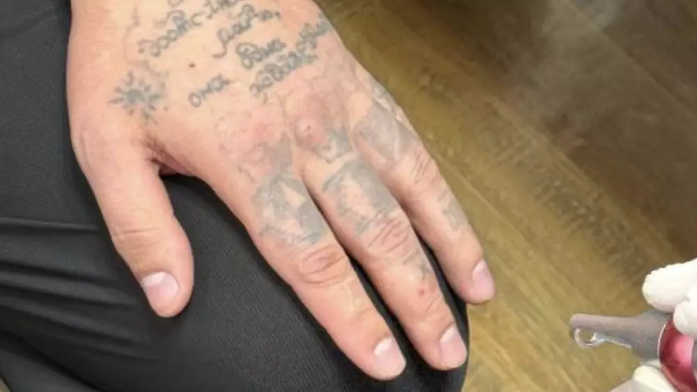 Прокуратура: Заключённые массово сводят с кожи следы тюремной романтики