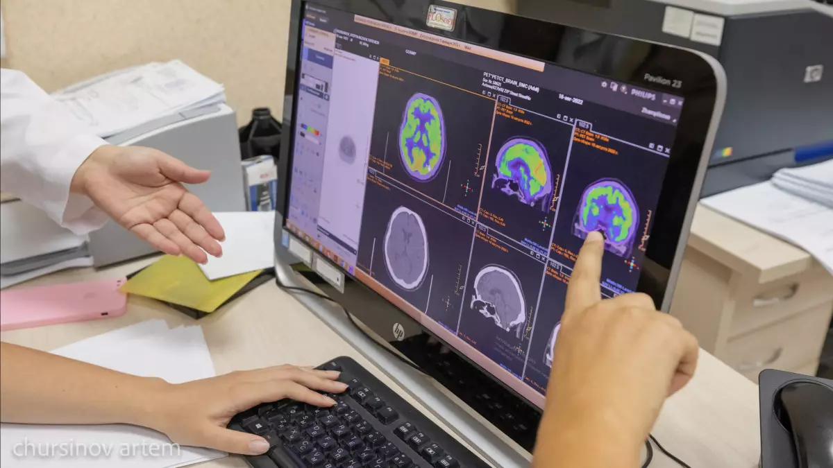 Невропатолог бас ауруымен күрестегі қауіпті әдістерді атады