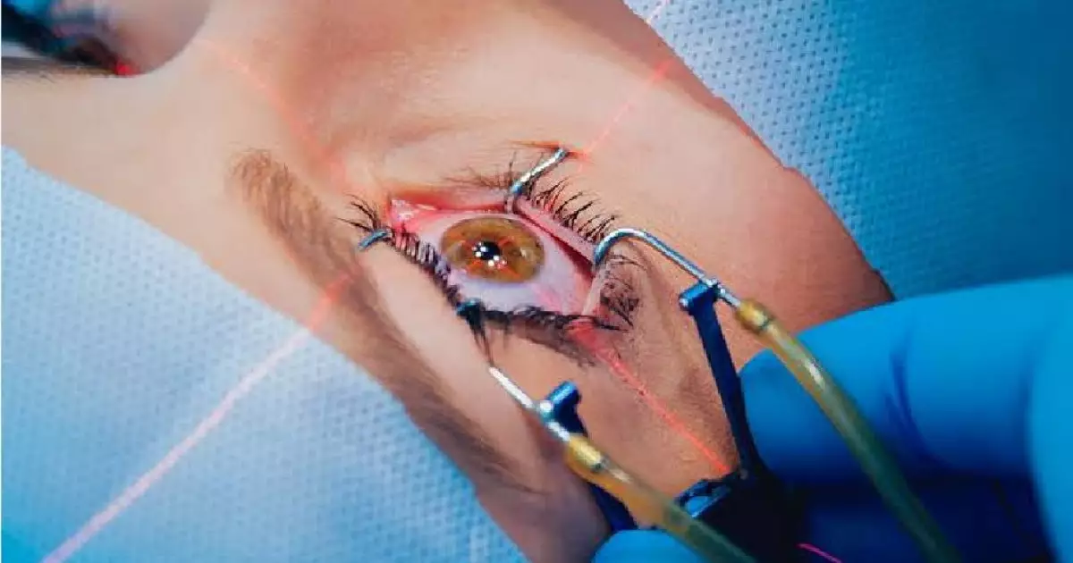   Қара көзден нұр тайса...   