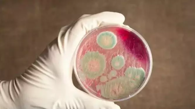 Алматы облысында сібір жарасы көмілімі табылды