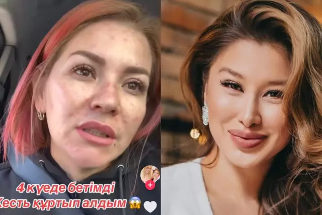 Актриса Әсел Асқардың жарнамасына сенген қыздың беті бөртіп кеткен