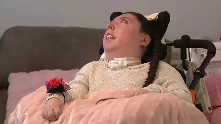 «Дәрігерлер оны өледі деген»: мисыз туған қыз 20 жасқа толды