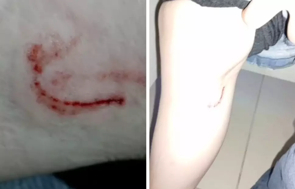 Көкшетауда 15 жастағы қызды иттер талап тастады