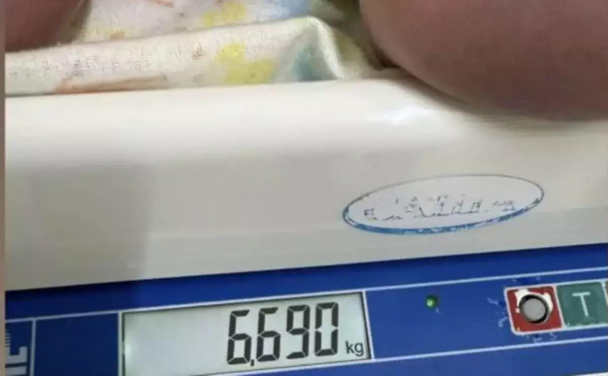 Девочка-гигант весом более 6 кг родилась в Мангистау