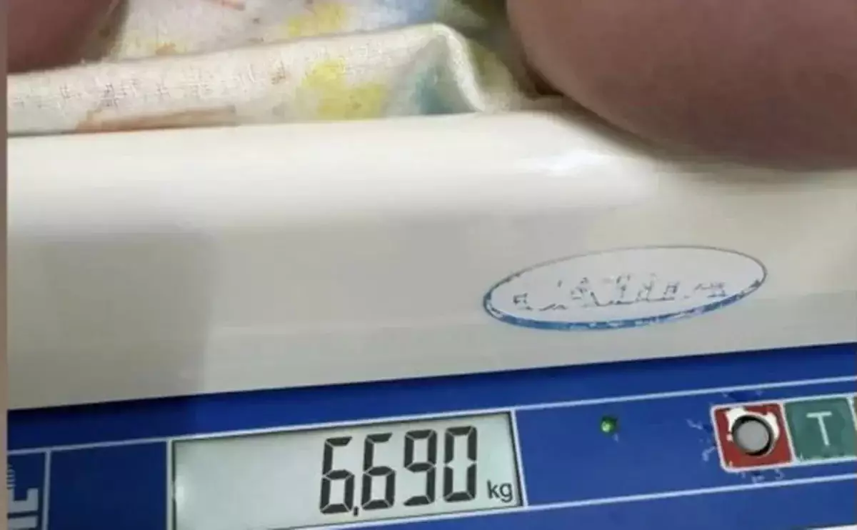 Маңғыстауда салмағы 6 келіден асатын алып сәби дүниеге келді