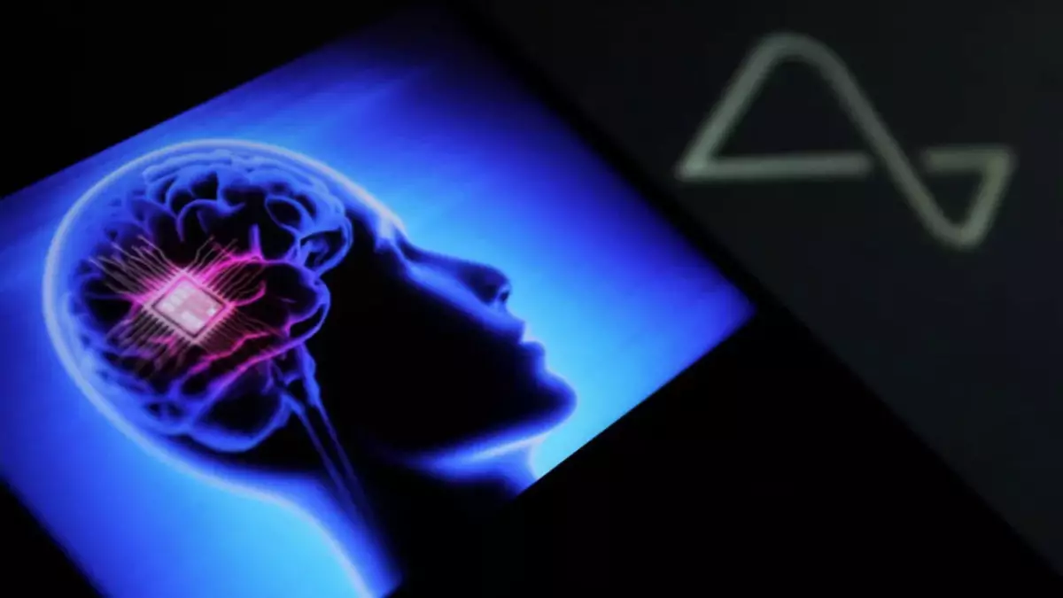 Көңіл күйді көтеретін ми имплантаты жасалды