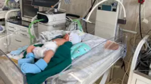 Алматылық дәрігерлер 742 грамм сәбиді аман алып қалды