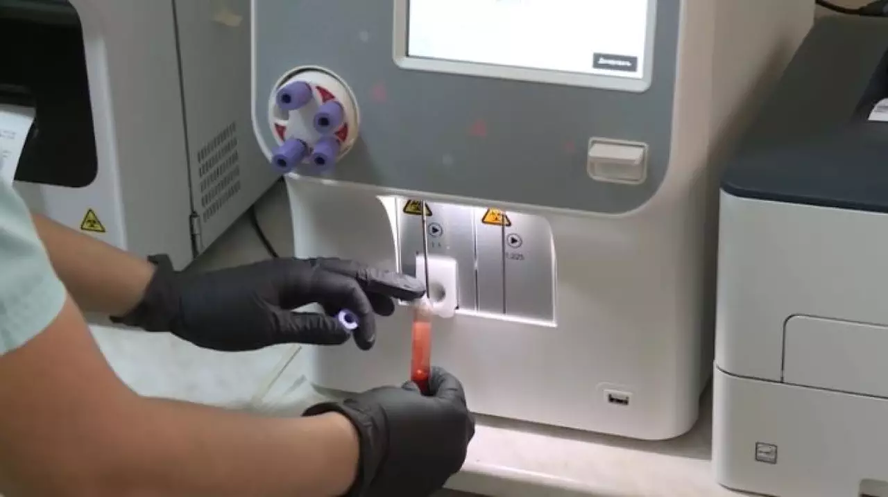 Сахарным диабетом в мире болеют 828 млн человек