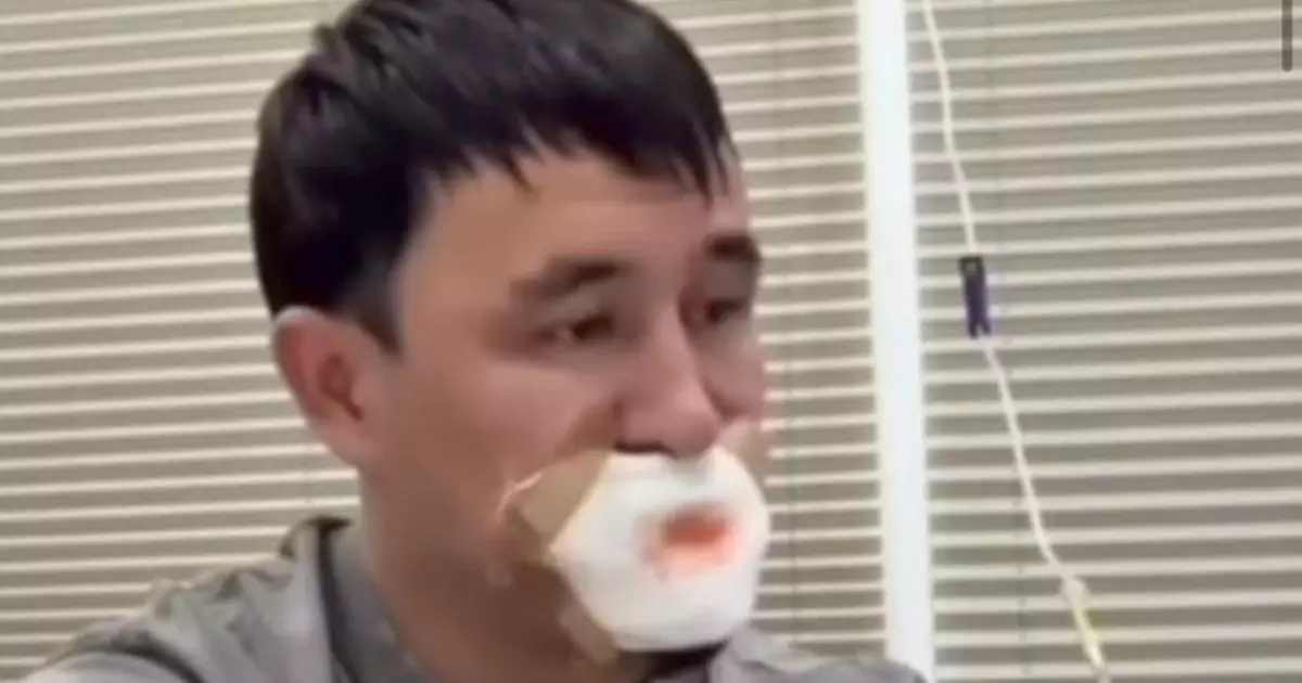  Қызбен сүйісемін деп тілінен айрылып қалған жігіт туралы тың мәлімет тарады 