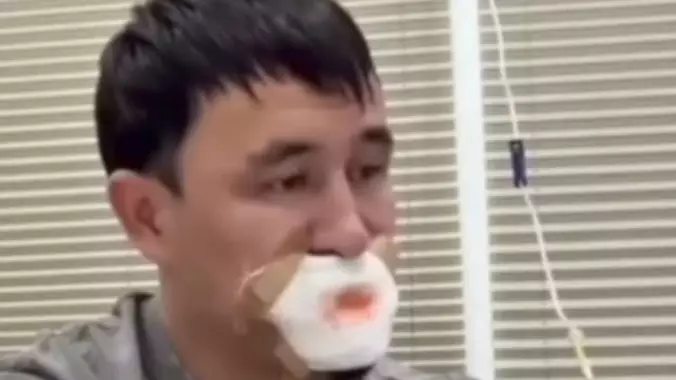 Қызымен сүйісіп тілінен айырылған жігіт туралы тың деректер тарады