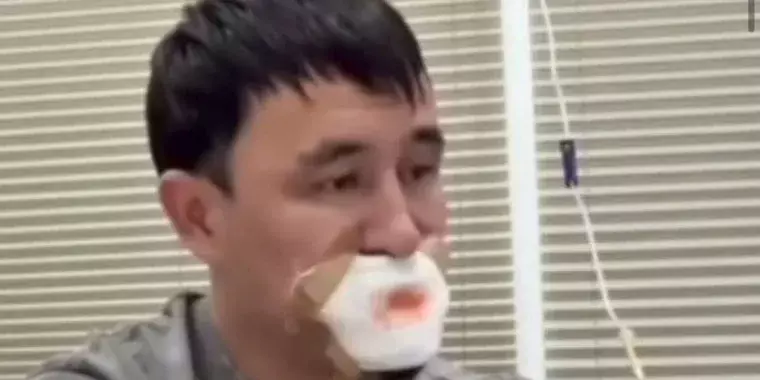 Қызбен сүйісемін деп тілінен айрылылған жігітке қатысты жаңа ақпарат шықты