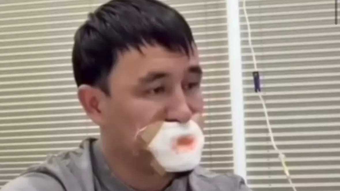 Сүйісіп, тілінен айырылған жігіт туралы тың ақпарат шықты