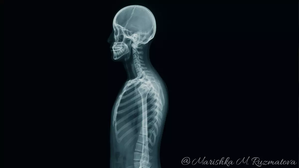 Учёные нашли способ самовосстановления костей