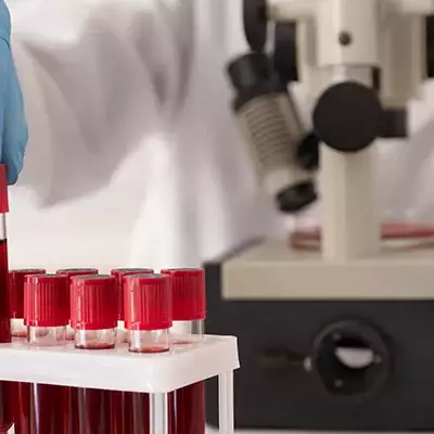 В крови людей переболевших COVID-19 обнаружили необычные изменения