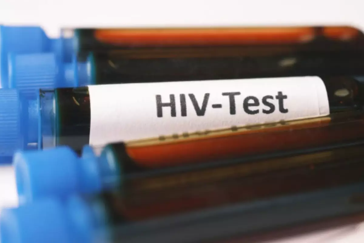 Каждый шестой житель Атырауской области прошёл тест на ВИЧ: озвучена статистика