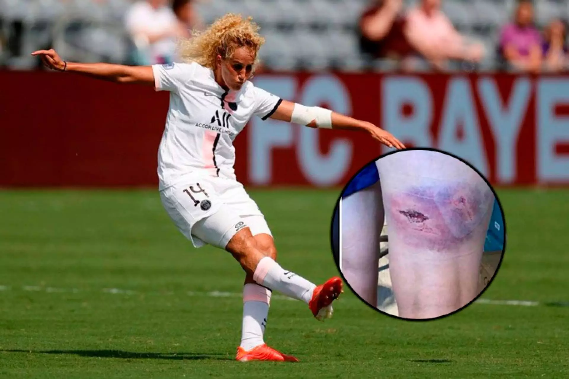 Экс-игрок «ПСЖ» требует миллионы после жестокого нападения