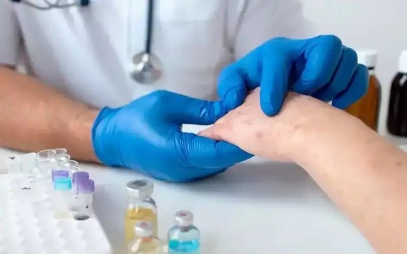 Почти 2 800 случаев кори зарегистрировано в Казахстане с начала 2025 года.