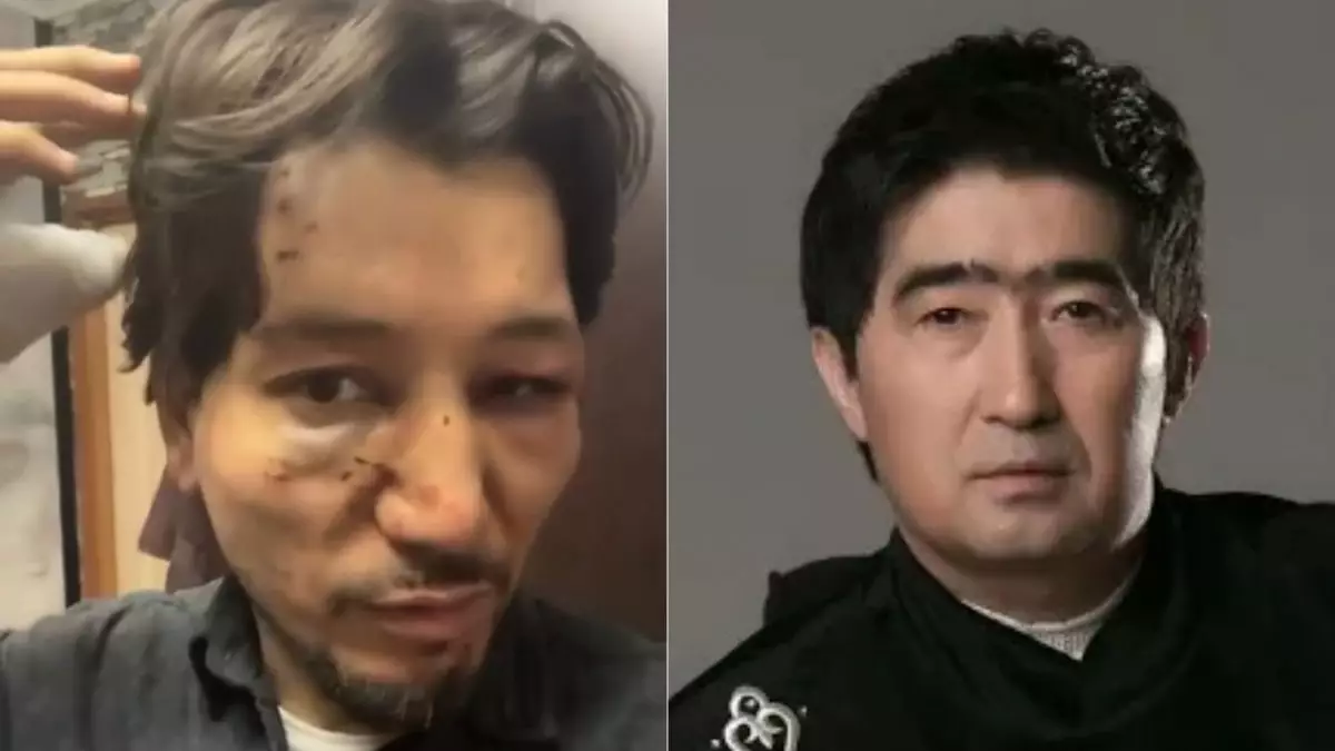 Новый участник группы  «Нур-Мукасан» обвинил Мукасана Шахзадаева в избиении