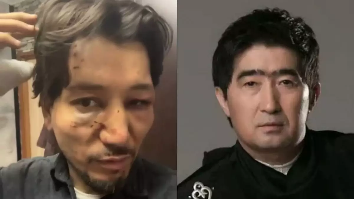 «Нұрмұқасан» тобының жаңа орындаушысы өзін Мұқасан Шахзадаев соққыға жыққанын айтты