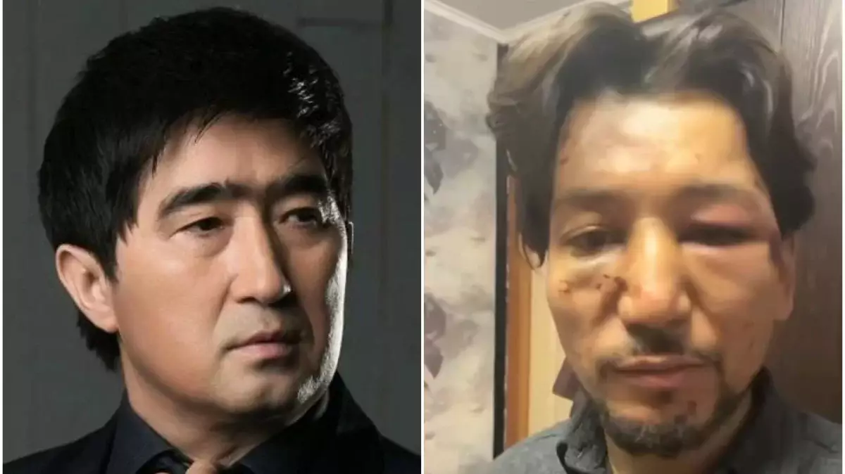 «Өлтіріп қоя жаздады»: Мұқасан Шахзадаев жас жігітті аяусыз соққыға жыққан