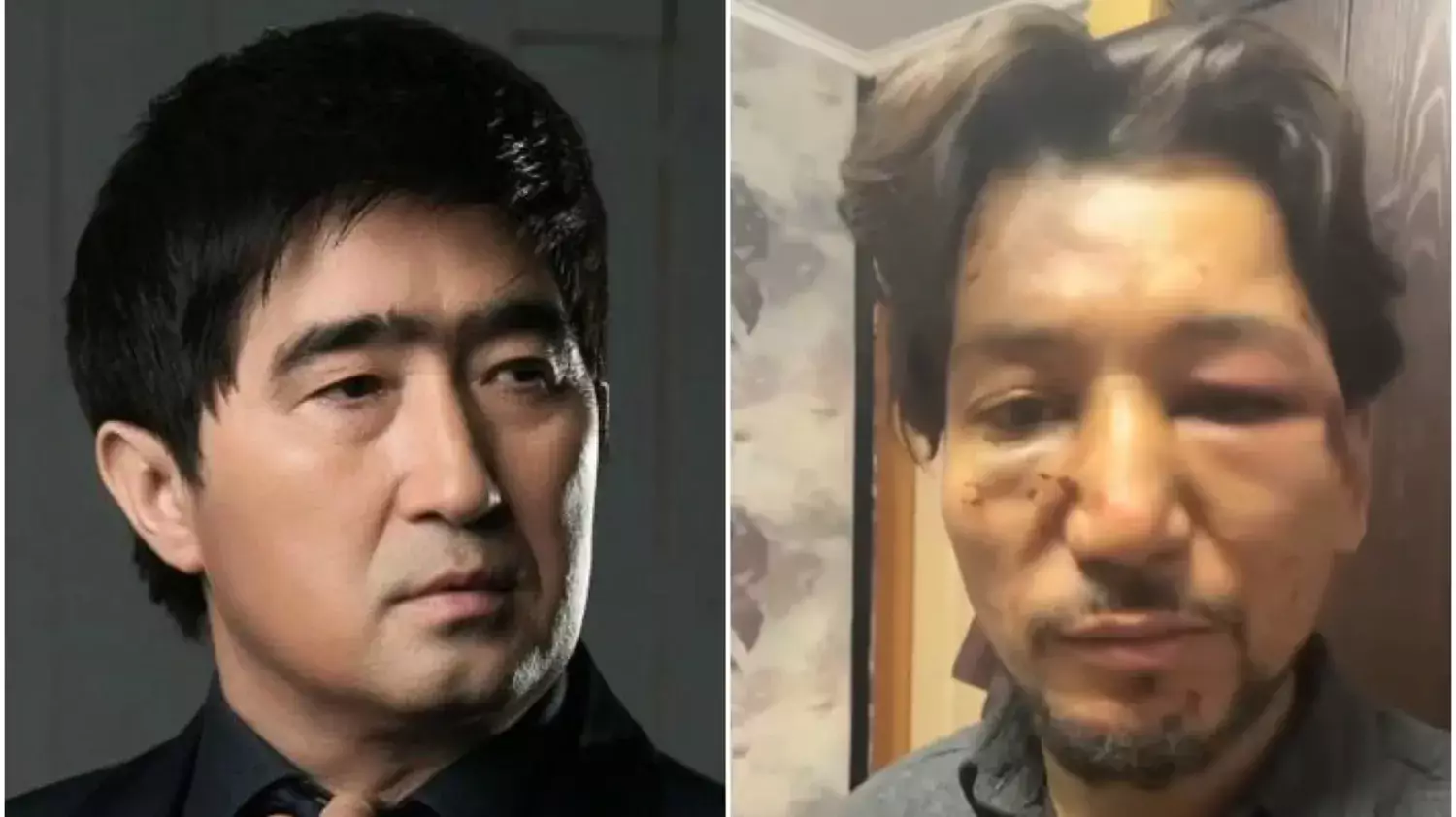 «Ән үшін өлтіріп қоя жаздады»: жас әнші Мұқасан Шахзадаевтан оңбай таяқ жеді (ВИДЕО)