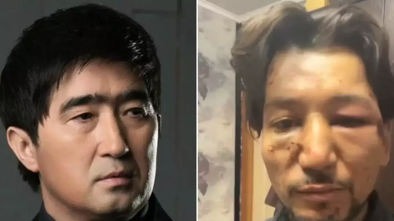 Мұқасан Шахзадаев ән үшін Ғалымжанның "бетін тегістап" жіберген