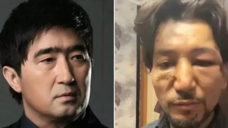 "Нұр-Мұқасан" тобында дау: Жас әншіні ұрып-соғып кеткен