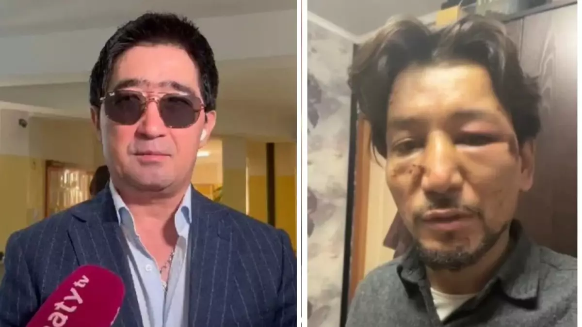 «Қолы мен мұрны сынған»: «Нұр-Мұқасан» тобының басы дауға қалды