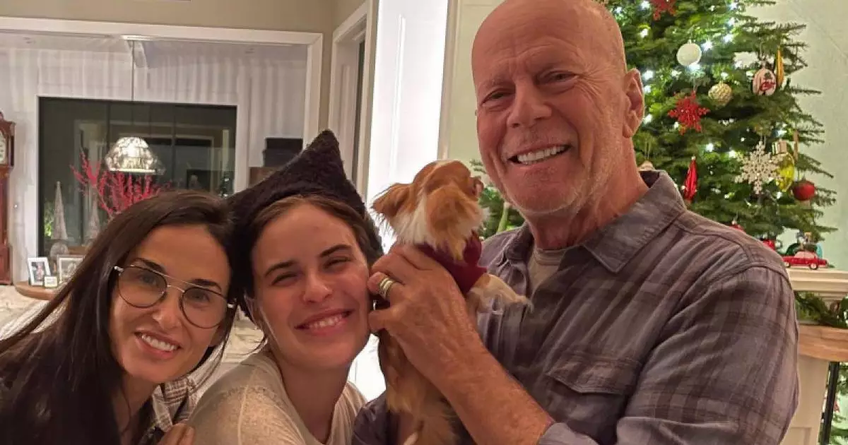  Ауыр дертке шалдыққан әйгілі актердің миын әйелі қайырымдылыққа бермек 