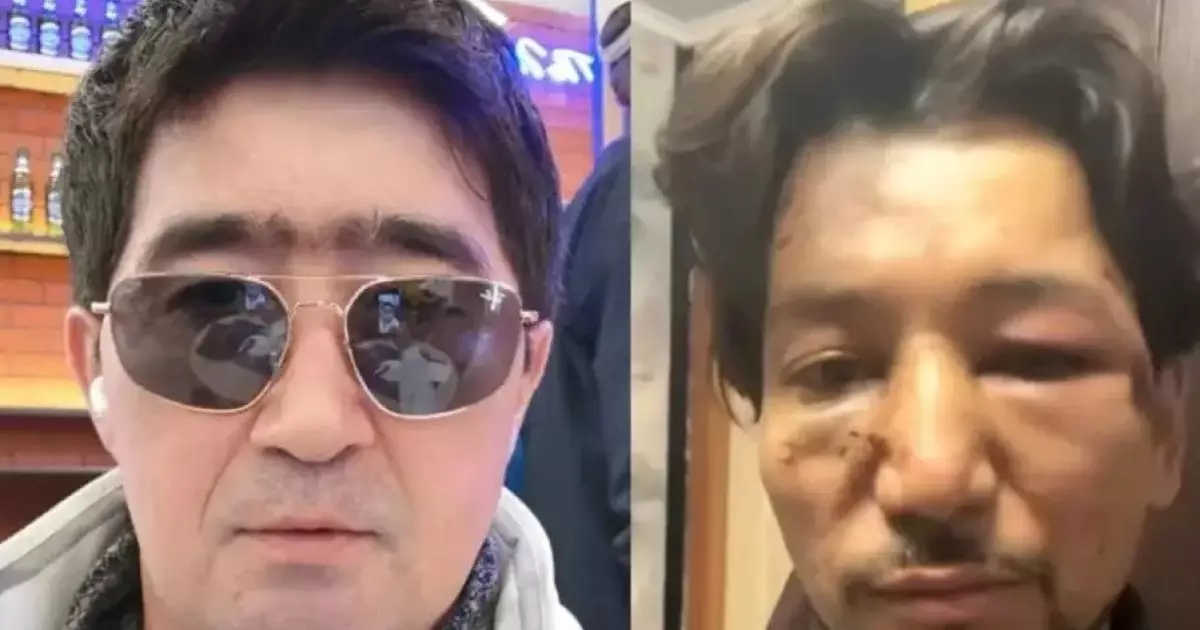  `Ғалымжанды есінен танығанша ұрған, оны алда операция күтіп тұр`: Мұқасан Шахзадаевқа тықыр таянды 