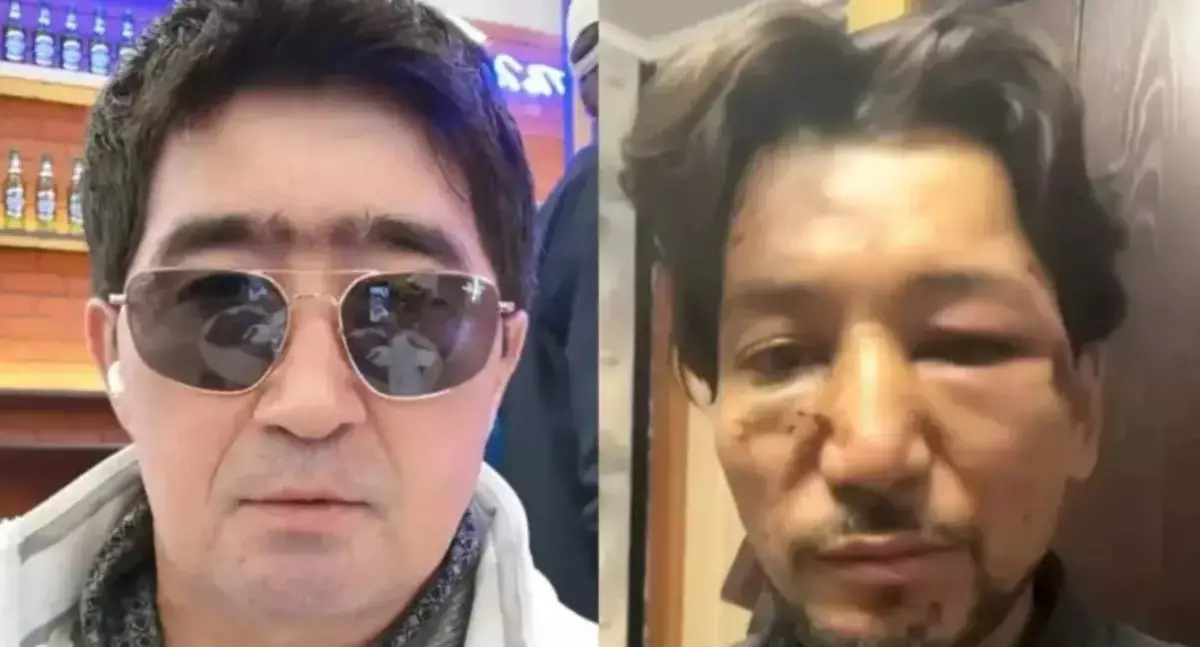 Мұрнын сындырған - Мұқасан Шахзадаевтың жұдырық жұмсағаны рас па