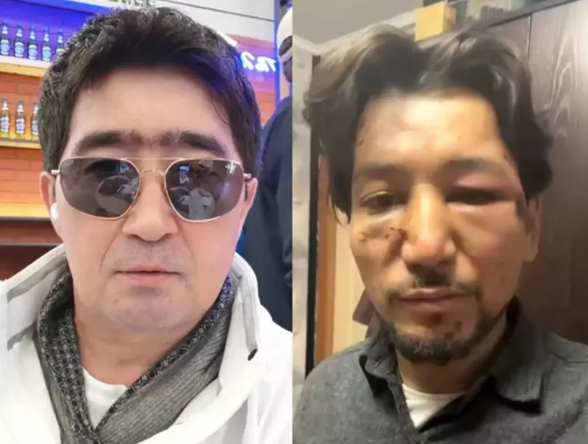 Конфликт в "Нур-Мукасан": участник заявил об избиении