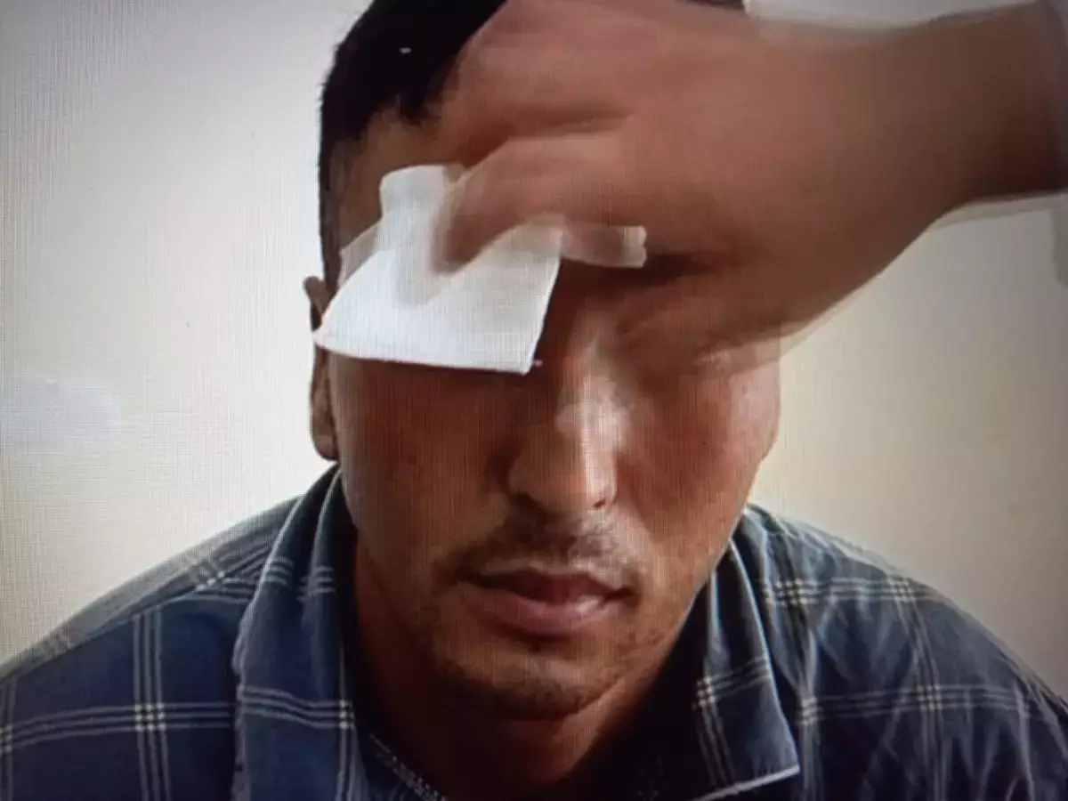 Контрактник в Казахстане лишился глаза, показывая, как надо бить стеклянные бутылки об голову - новости на Lada.kz 24.11.2025