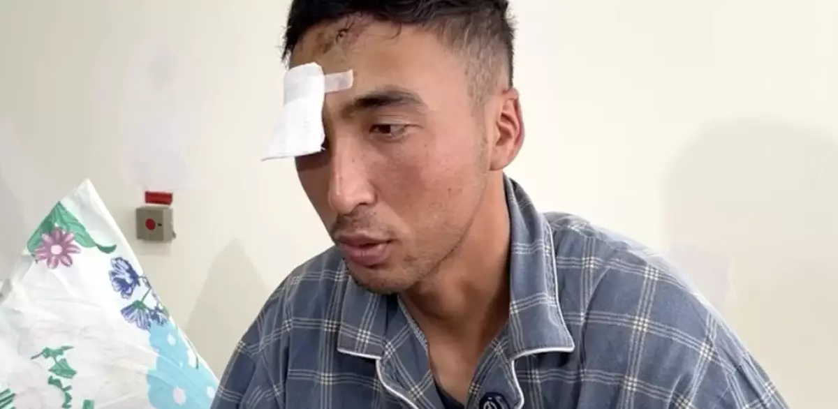 Контрактник лишился глаза во время присяги в Жамбылской области