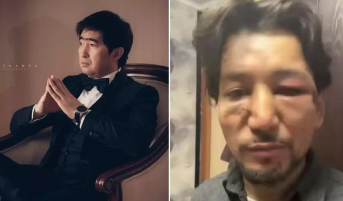 «Күрделі ота жасалмақ»: Мұқасан Шахзадаев соққыға жыққан әншінің жағдайы ауыр