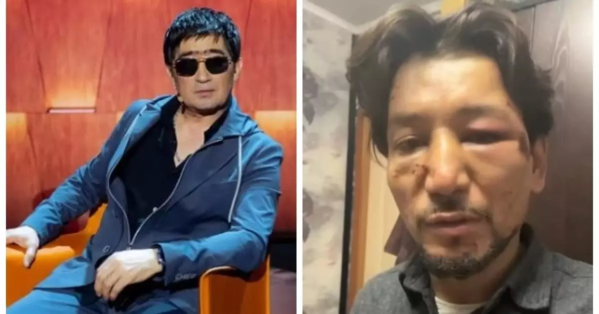  Жас әншіні ұрып-соқты делінген Мұқасан Шахзадаев жайлы танымал заңгер тосын пікір айтты 