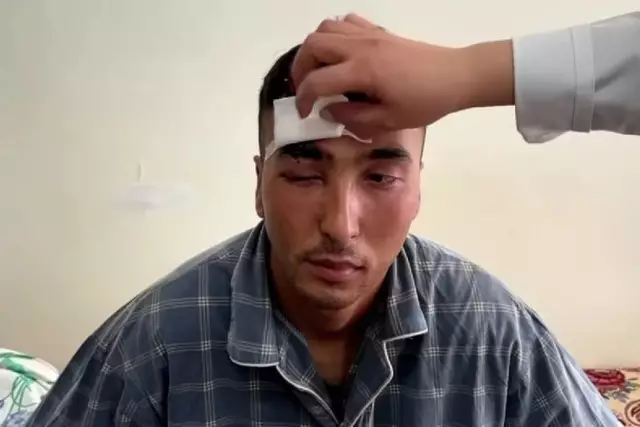 Жамбыл облысында әскери басына бөтелке жарам деп көзінен айырылды