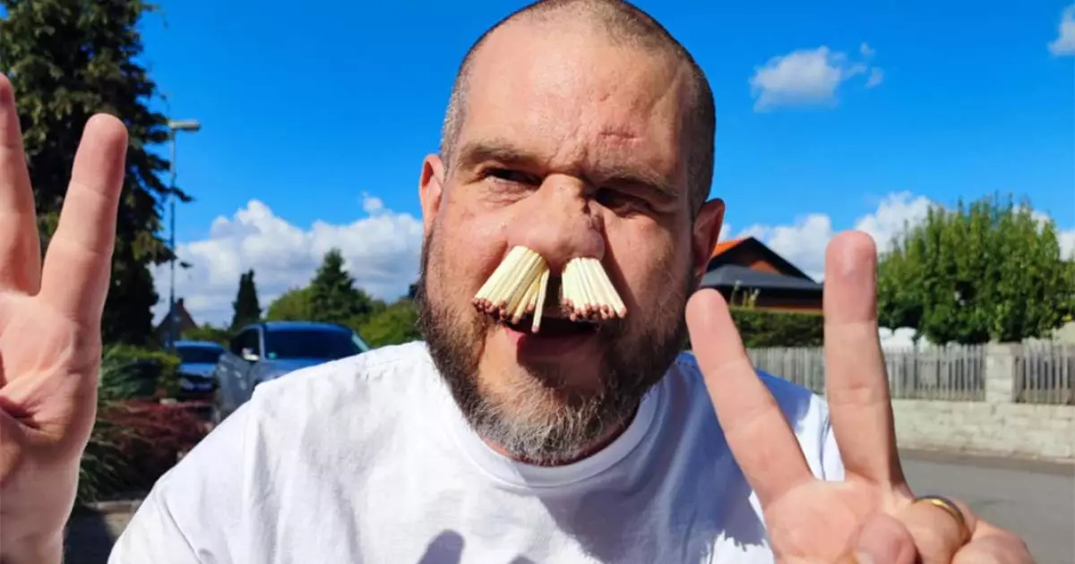  Балаларын қуантамын деп: Швеция тұрғыны мұрнына 81 шырпы тығып әлемдік рекорд орнатты 