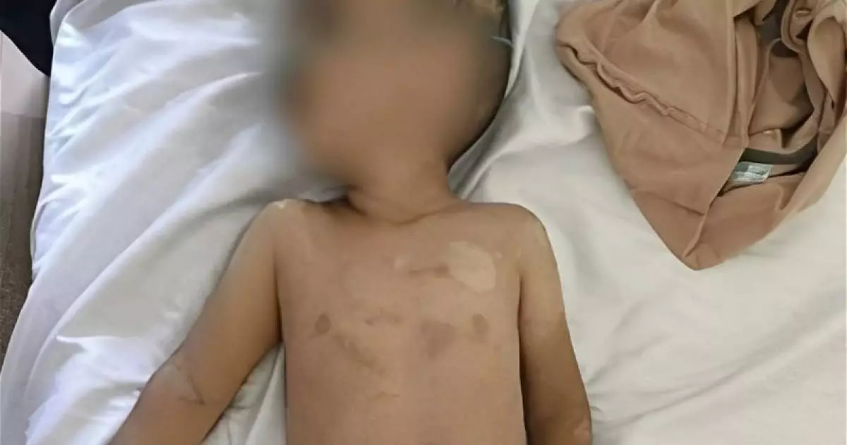  Түнде баланы ұрып, суық суға шомылдырған: ауыр халдегі бүлдіршін емханаға жеткізілді 