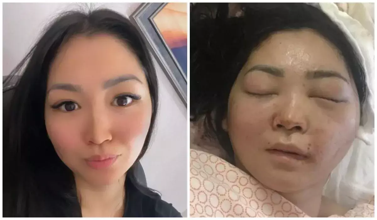 Әйелін соққыға жығып, мүгедек қылған ер адам бостандықта жүр ме?